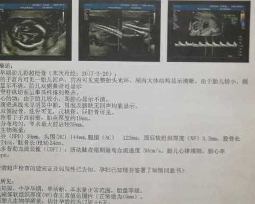促排导致卵巢囊肿多久消失